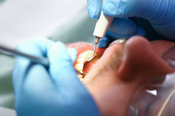 Best Dentist for Dental Trauma  in Crystal, MN